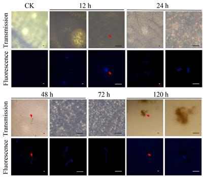 Elucidation of mechanisms underlying active oxygen burst in Citrus sinensis after Diaporthe citri infection using transcriptome analysis
